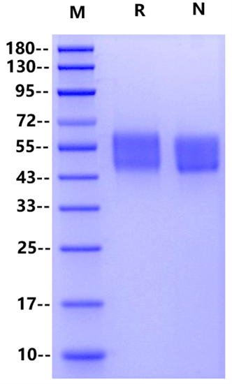 IL-3 Rα/CD123 His Tag Protein, Human