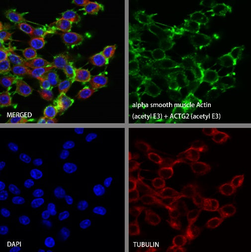 alpha smooth muscle Actin (acetyl E3) + ACTG2 (acetyl E3) Recombiant Rabbit mAb (S-3355)
