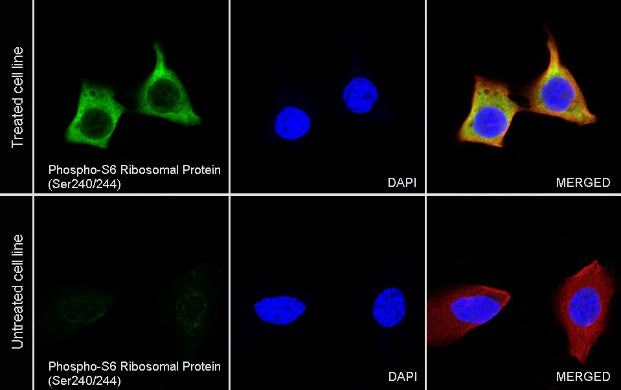 Phospho-S6 Ribosomal Protein (Ser240/244) Recombinant Rabbit mAb (S-R248)