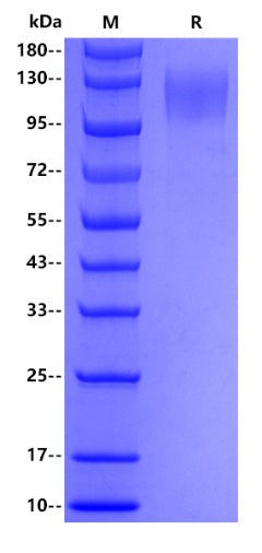 SARS-CoV-2 (COVID-19) S1, His tag