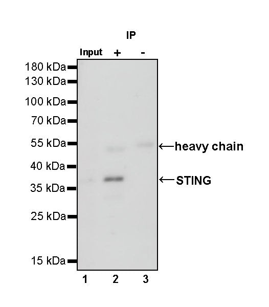 STING Recombinant Rabbit mAb (SDT-R150)