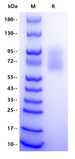 Rat IgE Protein, His tag