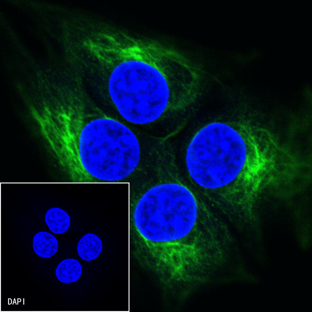 Desmin Recombinant Rabbit mAb (SDT-R022)