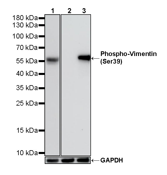 Phospho-Vimentin (Ser39) Rabbit Polyclonal Antibody