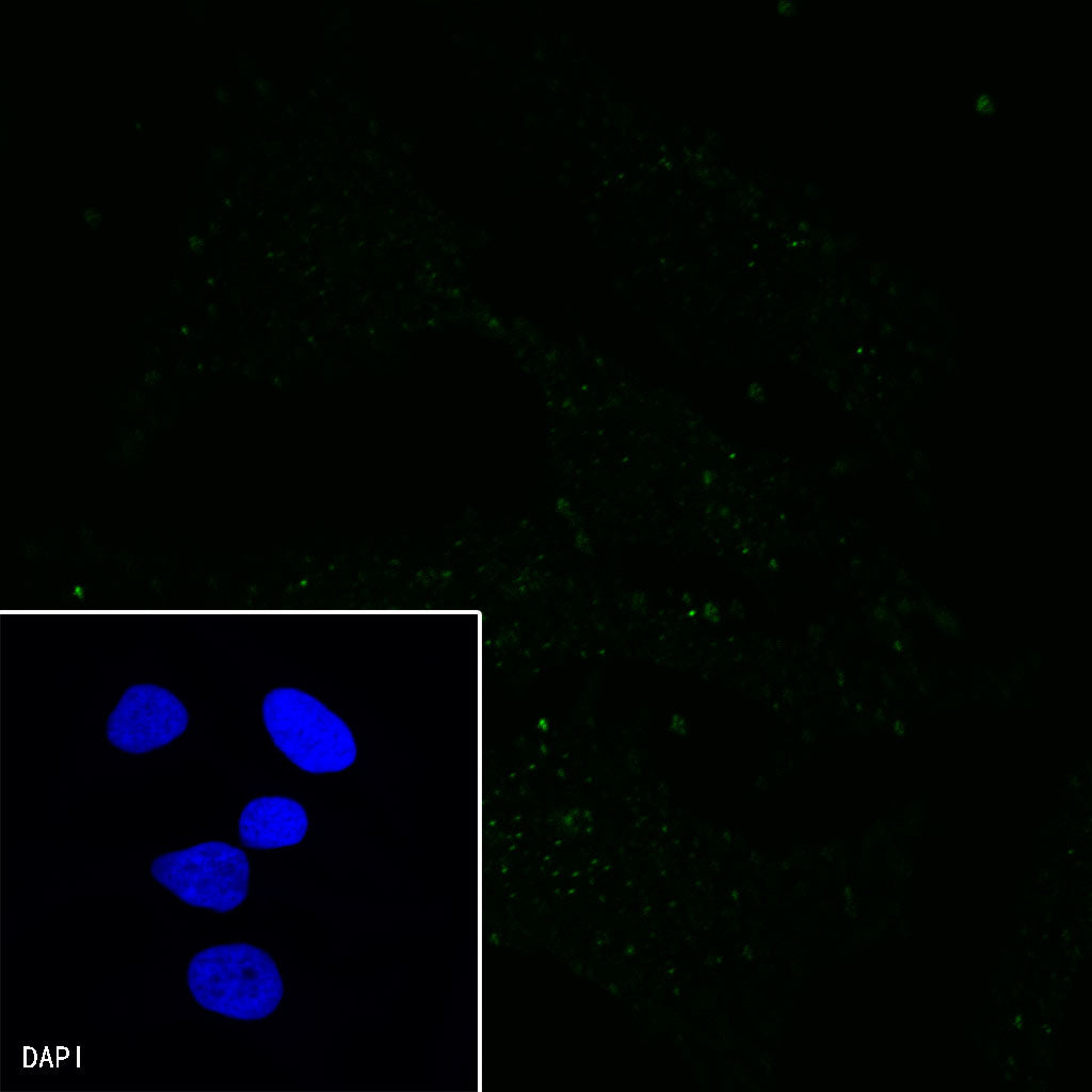 PMEL/Melanoma gp100 Recombinant Rabbit mAb (SDT-434-70)