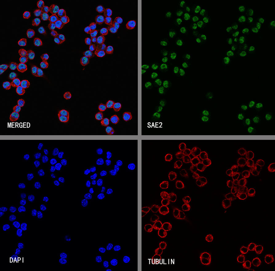 SAE2 Recombinant Rabbit mAb (S-4888-5)