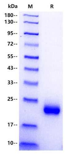 Human TMED4 Protein, His Tag