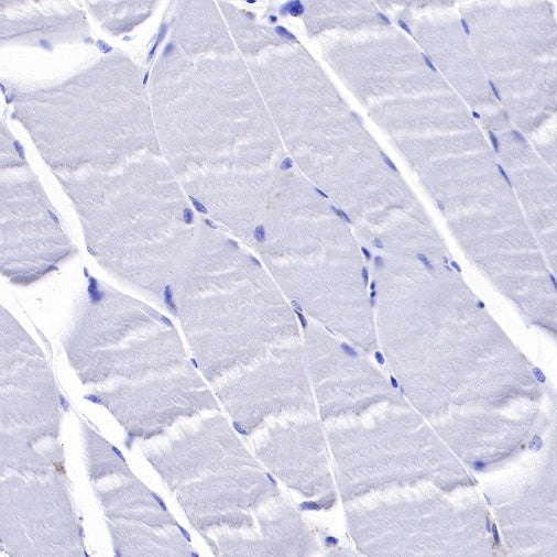 CD33 Recombinant Rabbit mAb (SDT-269-171)