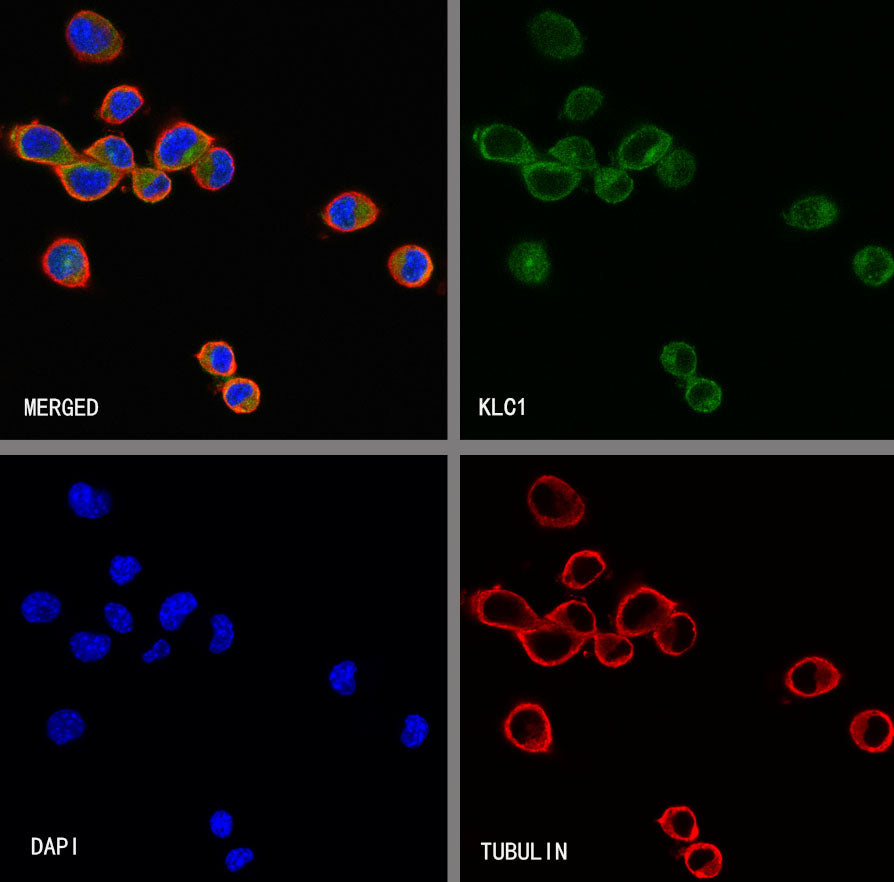 KLC1 Recombinant Rabbit mAb (S-4556-8)
