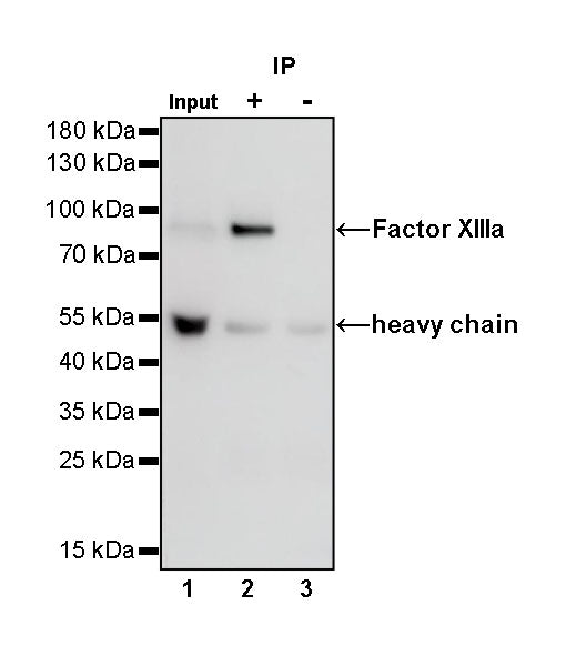 Factor XIIIa Recombinant Rabbit mAb (SDT-644-7)