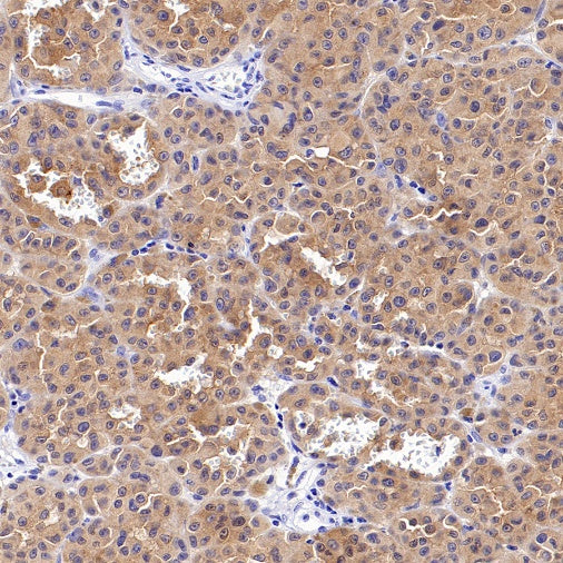 N-Ras (mutated Q61R) Recombinant Rabbit mAb (S-R155)
