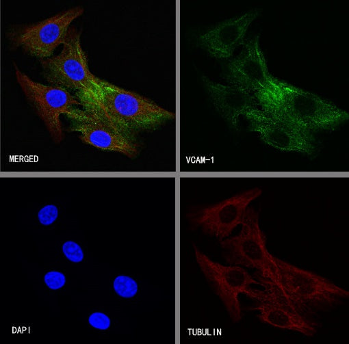 VCAM1 Recombinant Rabbit mAb (S-650-19)