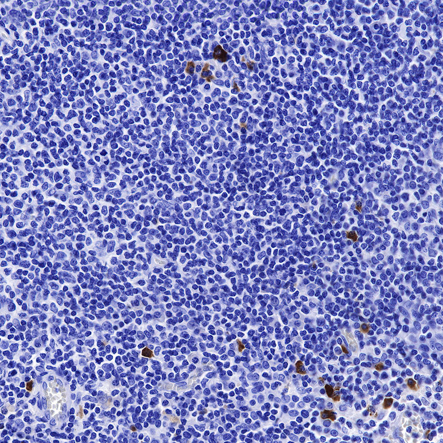 Human IgG2 F(c) Recombinant Rabbit mAb (SDT-318-75)