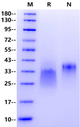 PVRIG His Tag Protein, Human