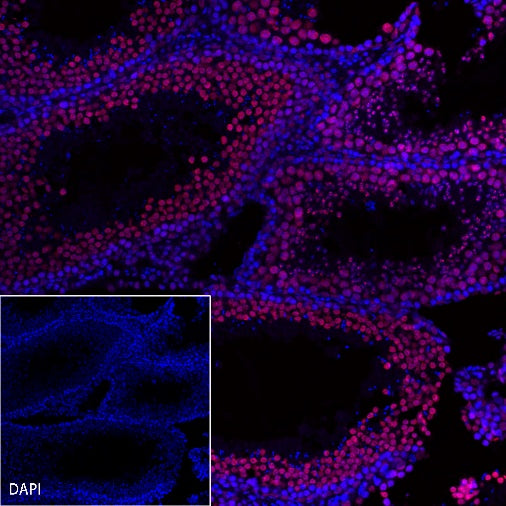Goat Anti-Rat IgG(H+L) (Alexa Fluor® 594 Conjugate)