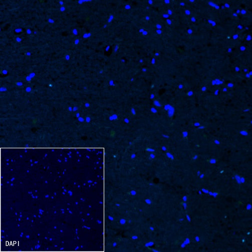 Cardiac Troponin I Recombinant Rabbit mAb (S-1352-28)
