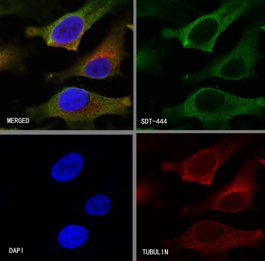 S-RMab®Annexin A2 Recombinant Rabbit mAb (SDT-444-67)