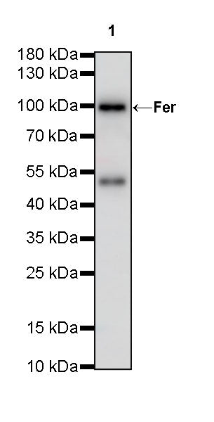 Fer Recombinant Rabbit mAb (S-R303)