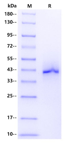 Human ADAM23 Protein, His tag