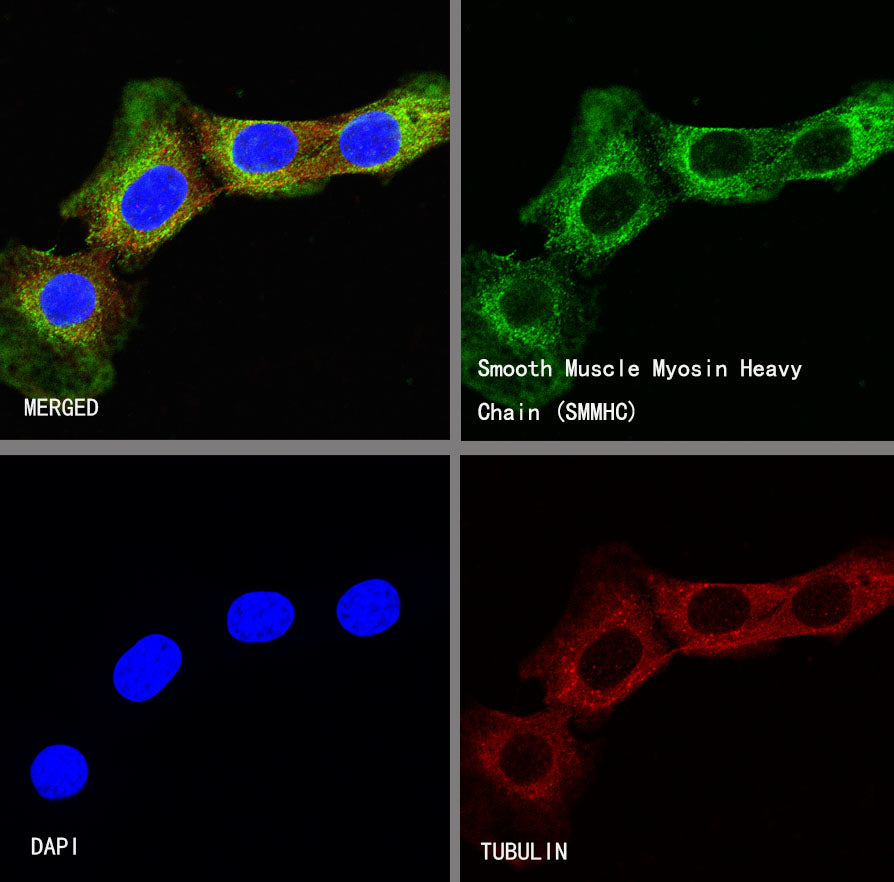 Smooth Muscle Myosin Heavy Chain (SMMHC) Recombinant Rabbit mAb (SDT-R089)