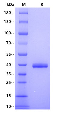 Escherichia coli MCR-1 Protein, His Tag