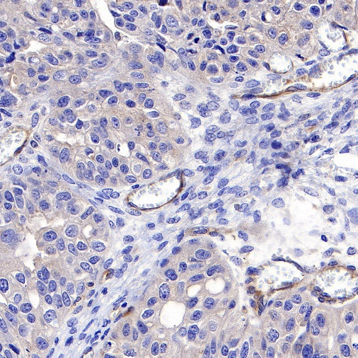 VEGF Receptor 2/FLK-1 Recombinant Rabbit mAb (S-R400)