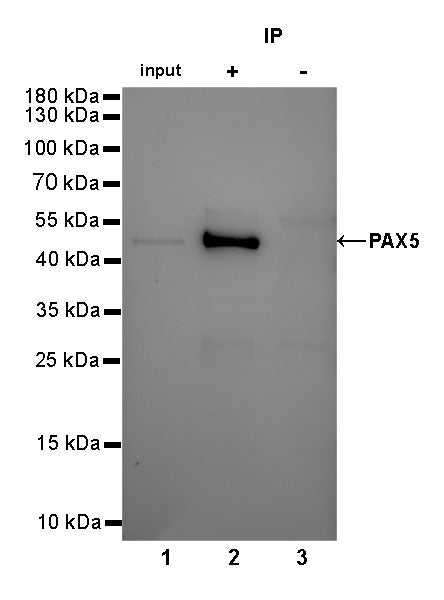 PAX5 Recombinant rabbit mAb (SDT-120-73)
