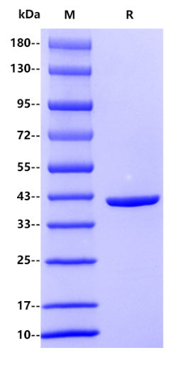 E. coli MBP His Tag Protein