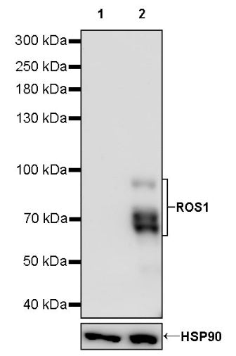 ROS1 Recombinant Rabbit mAb (S-2048-279)