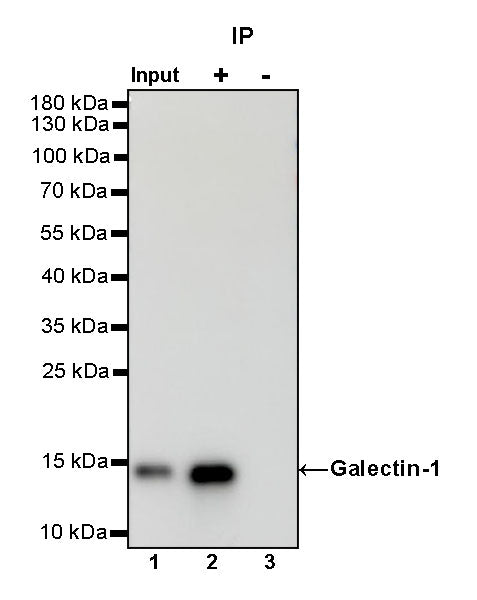 Galectin-1 Recombinant Rabbit mAb (S-1221-32)