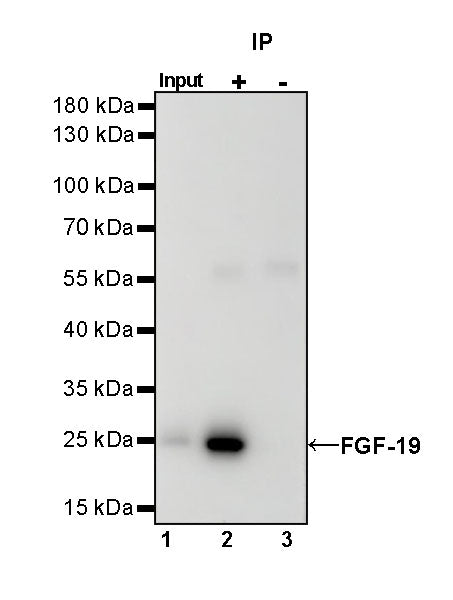 FGF-19 Recombinant Rabbit mAb (SDT-1070-17)