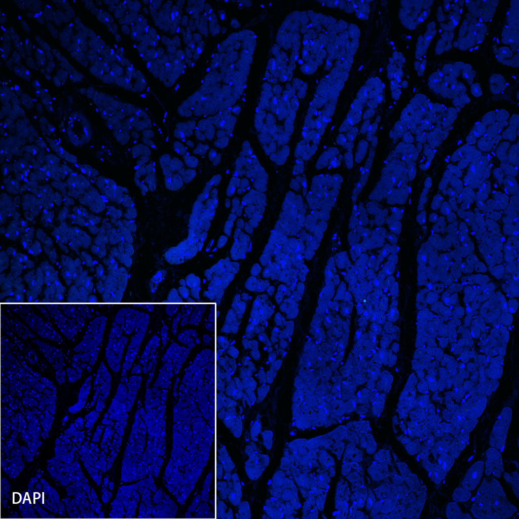 ACTH Recombinant Rabbit mAb (SDT-363-60)