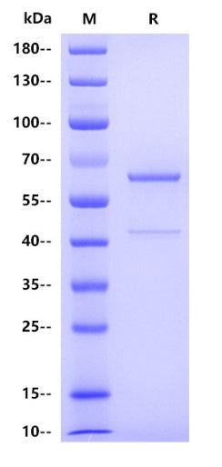 Human Akt1 Protein, His tag