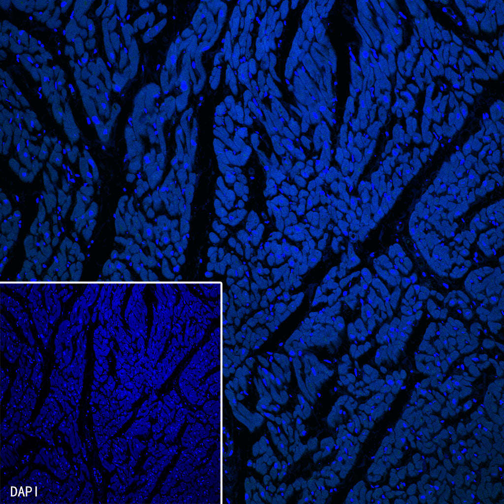 PTH Recombinant Rabbit mAb (SDT-407-4)