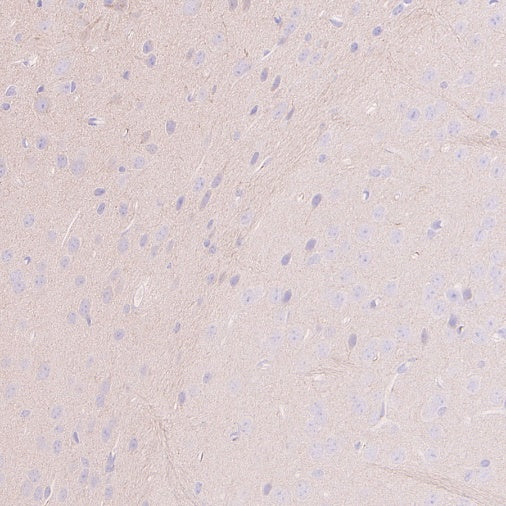 IRGQ Recombinant Rabbit mAb (S-2648-17)
