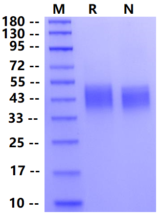 Biotinylated Fc γ RIIIb/CD16b(NA2) His&Avi Tag Protein, Human