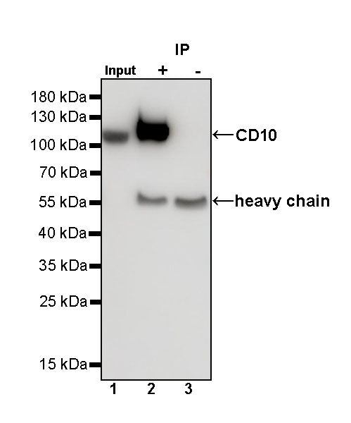 CD10 Recombinant Rabbit mAb (SDT-006-77)