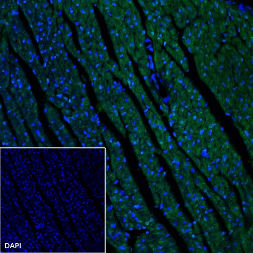Ndufs4 Recombinant Rabbit mAb (S-1459-14)