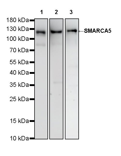 SMARCA5 Recombinant Rabbit mAb (S-4446-48)