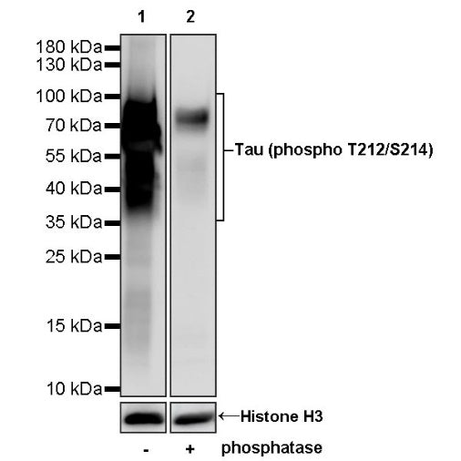 Tau (phospho T212/S214) Recombinant Rabbit mAb (S-1538-74)