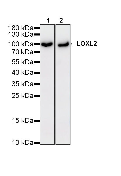LOXL2 Recombinant Rabbit mAb (S-4565-21)