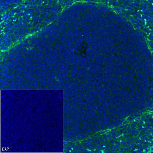 CD36 Recombinant Rabbit mAb (S-1028-127)