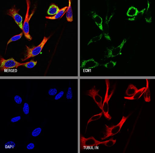 ECM1 Recombinant Rabbit mAb (S-2235-35)