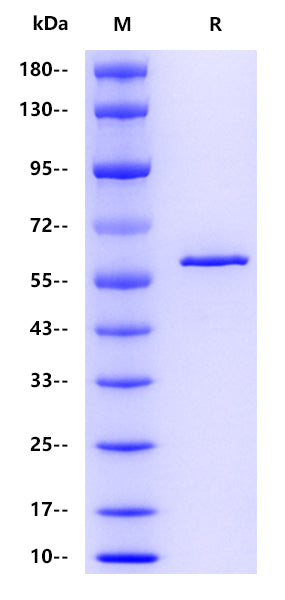 Influenza A virus NP(A/Hong Kong/1/1968 H3N2), His tag