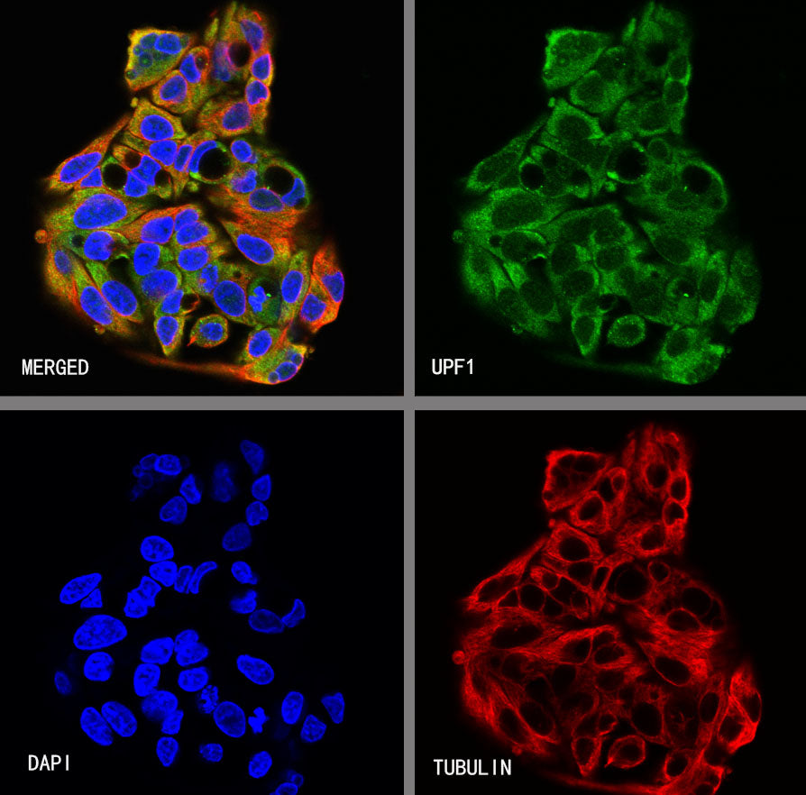UPF1 Rabbit Polyclonal Antibody