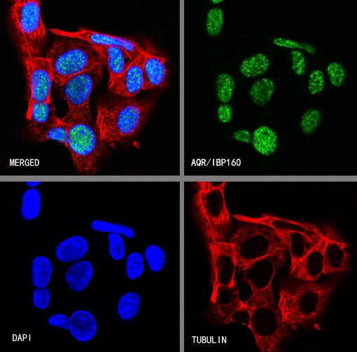 AQR/IBP160 Recombinant Rabbit mAb (S-1329-248)