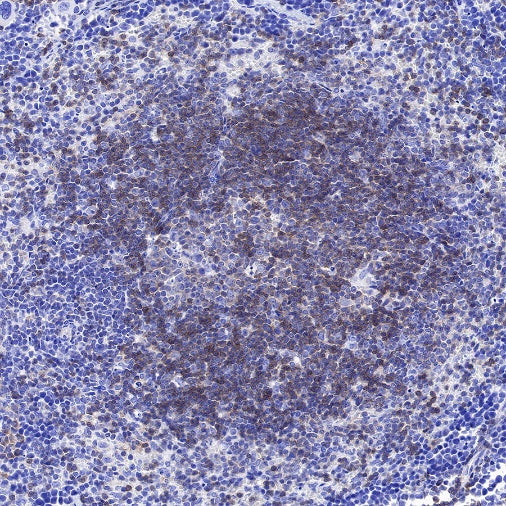 BTLA/CD272 Recombinant Rabbit mAb (S-742-13)