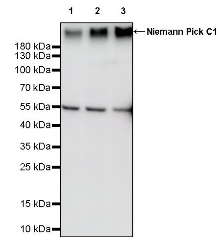 Niemann Pick C1 Recombinant Rabbit mAb (S-3160-43)