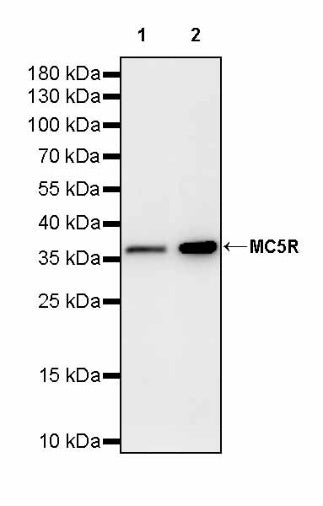 MC5R Recombinant Rabbit mAb (S-3142-41)