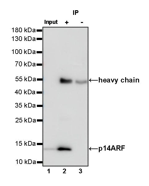 p14ARF Recombinant Rabbit mAb (S-R244)